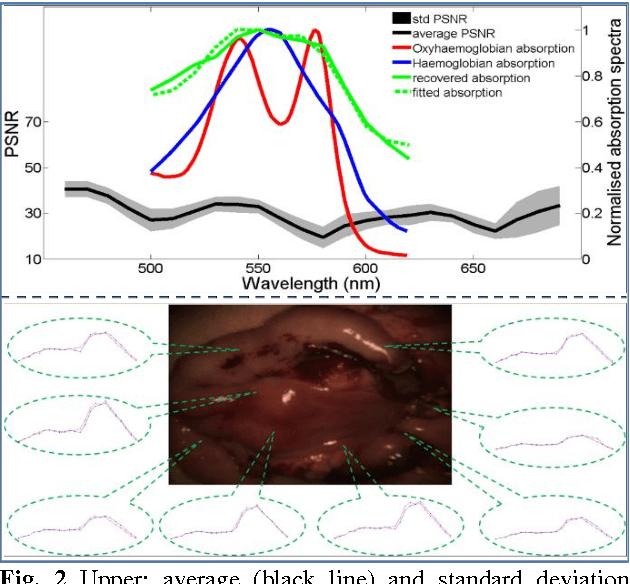 Figure 2 for Recovering Dense Tissue Multispectral Signal from in vivo RGB Images