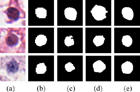 Figure 2 for Meta Mask Correction for Nuclei Segmentation in Histopathological Image