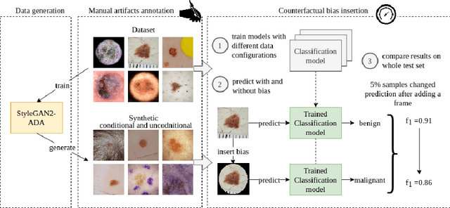 Figure 1 for The (de)biasing effect of GAN-based augmentation methods on skin lesion images