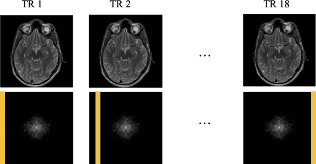 Figure 3 for FSE Compensated Motion Correction for MRI Using Data Driven Methods