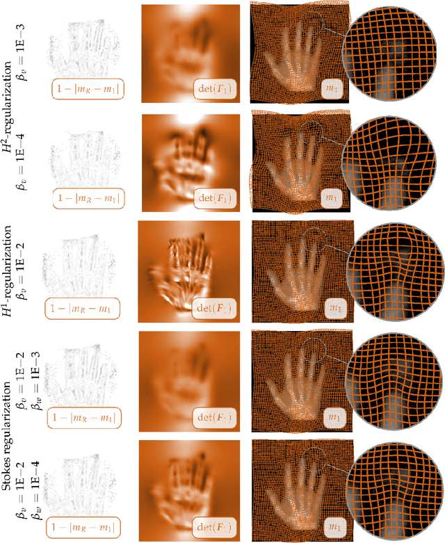 Figure 4 for Constrained $H^1$-regularization schemes for diffeomorphic image registration