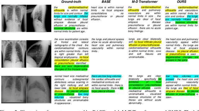 Figure 3 for Confidence-Guided Radiology Report Generation