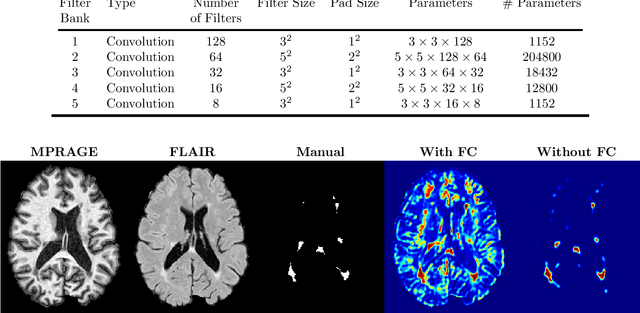 Figure 4 for Multiple Sclerosis Lesion Segmentation from Brain MRI via Fully Convolutional Neural Networks