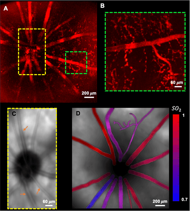 Figure 4 for In vivo functional and structural retina imaging using multimodal photoacoustic remote sensing microscopy and optical coherence tomography