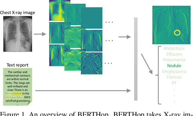 Figure 1 for BERTHop: An Effective Vision-and-Language Model for Chest X-ray Disease Diagnosis