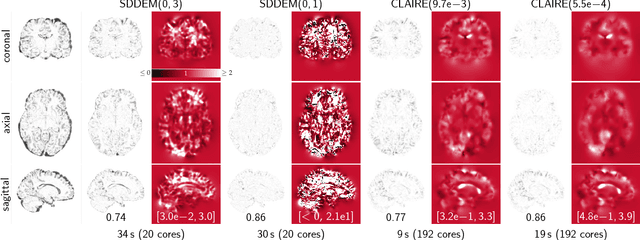 Figure 2 for CLAIRE: A distributed-memory solver for constrained large deformation diffeomorphic image registration