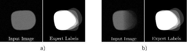 Figure 1 for On the Effect of Inter-observer Variability for a Reliable Estimation of Uncertainty of Medical Image Segmentation