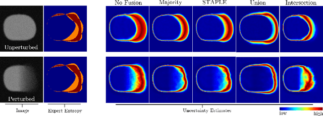 Figure 3 for On the Effect of Inter-observer Variability for a Reliable Estimation of Uncertainty of Medical Image Segmentation