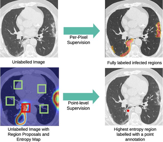 Figure 1 for A Weakly Supervised Region-Based Active Learning Method for COVID-19 Segmentation in CT Images