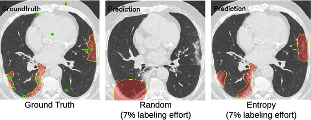 Figure 3 for A Weakly Supervised Region-Based Active Learning Method for COVID-19 Segmentation in CT Images