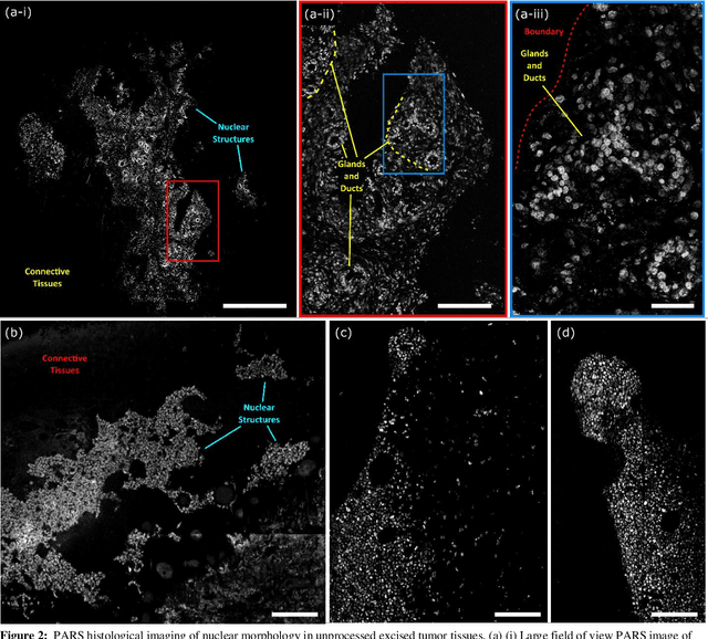 Figure 2 for Three-Dimensional Virtual Histology in Unprocessed Resected Tissues with Photoacoustic Remote Sensing (PARS) Microscopy and Optical Coherence Tomography