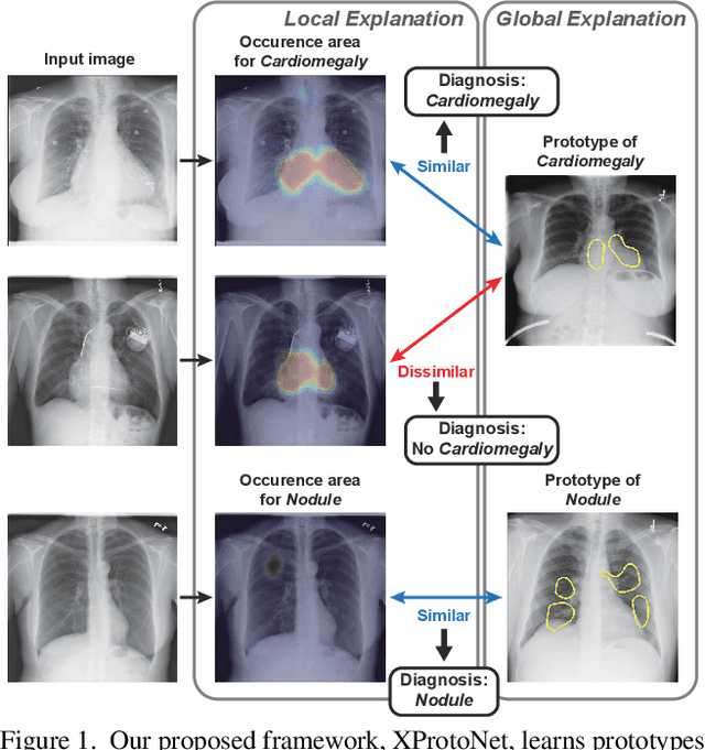 Figure 1 for XProtoNet: Diagnosis in Chest Radiography with Global and Local Explanations