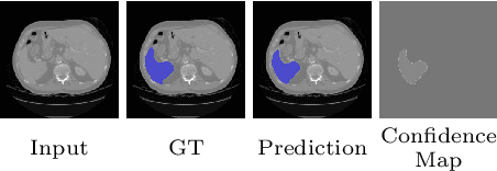 Figure 3 for Duo-SegNet: Adversarial Dual-Views for Semi-Supervised Medical Image Segmentation