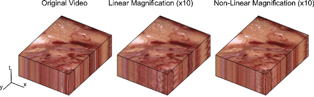 Figure 3 for Higher Order of Motion Magnification for Vessel Localisation in Surgical Video