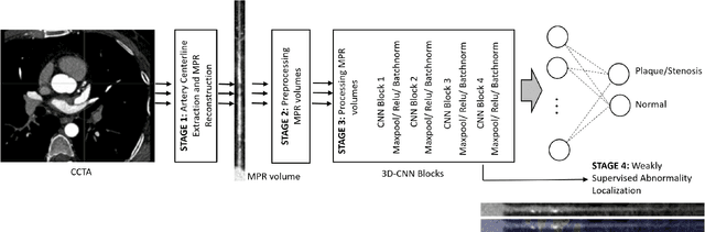 Figure 3 for Coronary Artery Classification and Weakly Supervised Abnormality Localization on Coronary CT Angiography with 3-Dimensional Convolutional Neural Networks