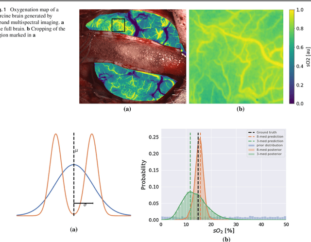 Figure 1 for Uncertainty-aware performance assessment of optical imaging modalities with invertible neural networks