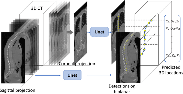 Figure 3 for Vertebrae segmentation, identification and localization using a graph optimization and a synergistic cycle