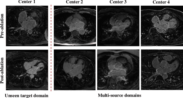 Figure 1 for AtrialGeneral: Domain Generalization for Left Atrial Segmentation of Multi-Center LGE MRIs