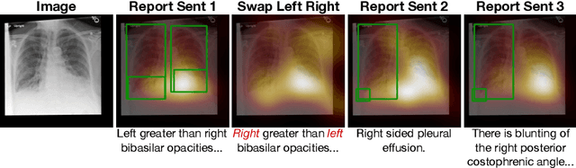 Figure 1 for That's the Wrong Lung! Evaluating and Improving the Interpretability of Unsupervised Multimodal Encoders for Medical Data