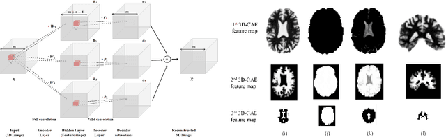 Figure 1 for Alzheimer's Disease Diagnostics by a Deeply Supervised Adaptable 3D Convolutional Network