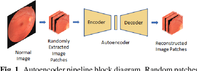 Figure 1 for Anomaly Detection in Retinal Images using Multi-Scale Deep Feature Sparse Coding