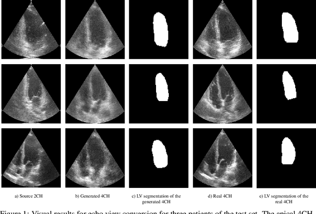 Figure 1 for A Study into Echocardiography View Conversion