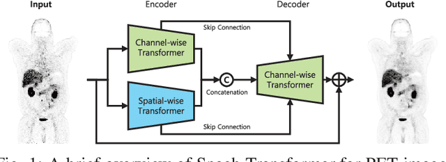 Figure 1 for Spach Transformer: Spatial and Channel-wise Transformer Based on Local and Global Self-attentions for PET Image Denoising