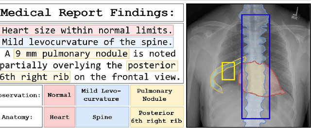 Figure 1 for Detailed Annotations of Chest X-Rays via CT Projection for Report Understanding