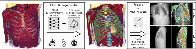 Figure 3 for Detailed Annotations of Chest X-Rays via CT Projection for Report Understanding