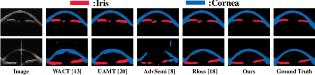 Figure 4 for A Macro-Micro Weakly-supervised Framework for AS-OCT Tissue Segmentation