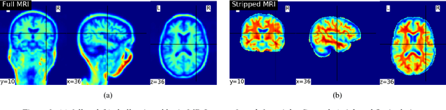 Figure 3 for End-to-End Parkinson Disease Diagnosis using Brain MR-Images by 3D-CNN