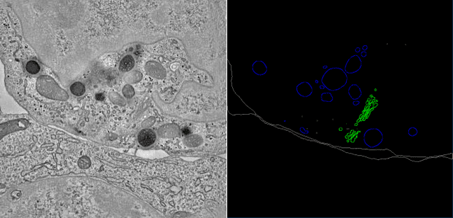 Figure 1 for SegET: Deep Neural Network with Rich Contextual Features for Cellular Structures Segmentation in Electron Tomography Image