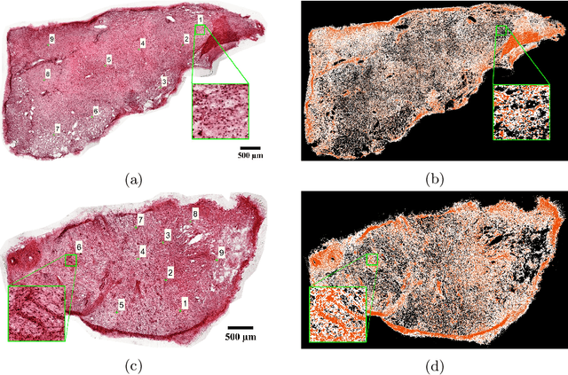 Figure 2 for Whole-Sample Mapping of Cancerous and Benign Tissue Properties