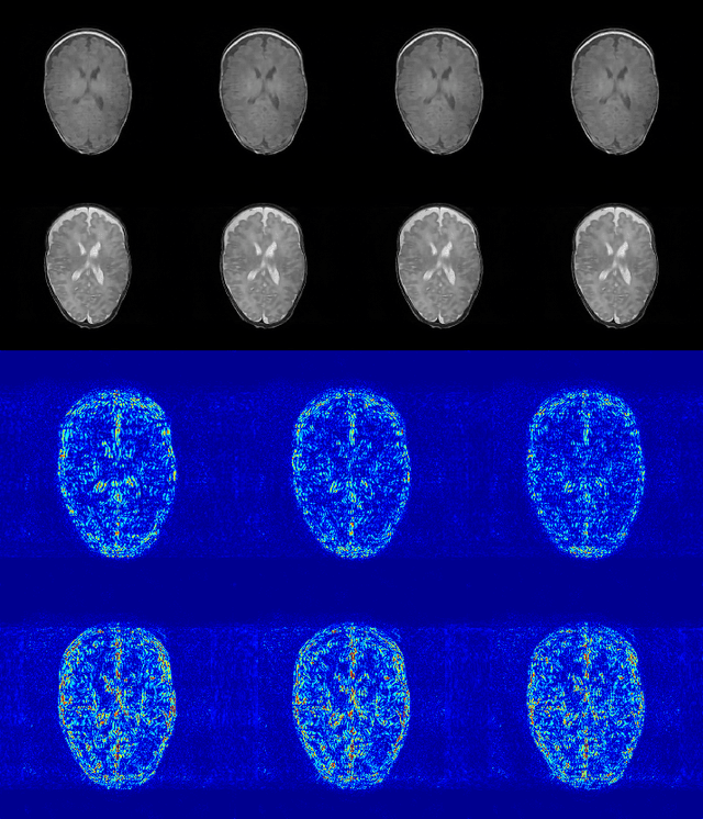 Figure 4 for A Deep Information Sharing Network for Multi-contrast Compressed Sensing MRI Reconstruction