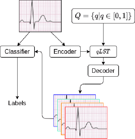 Figure 1 for Interpretable ECG classification via a query-based latent space traversal (qLST)