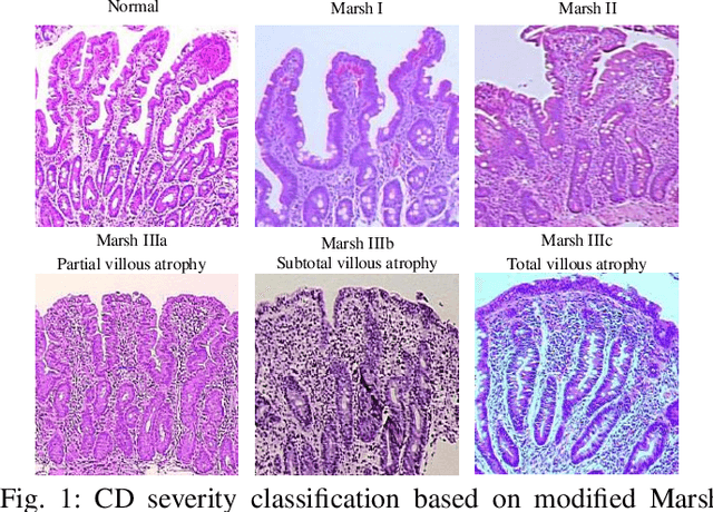 Figure 1 for CeliacNet: Celiac Disease Severity Diagnosis on Duodenal Histopathological Images Using Deep Residual Networks