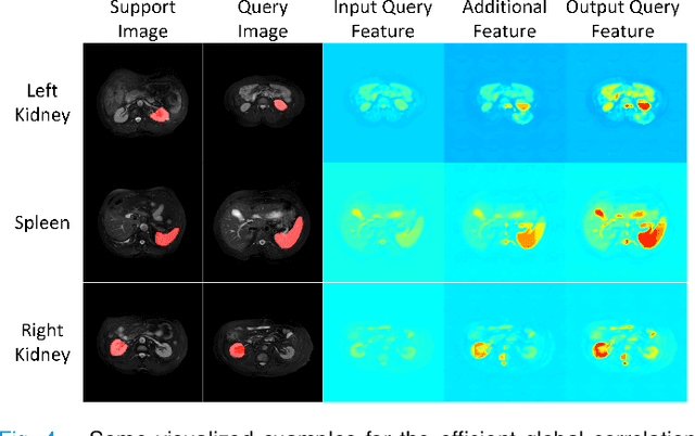 Figure 4 for Few-shot Medical Image Segmentation using a Global Correlation Network with Discriminative Embedding