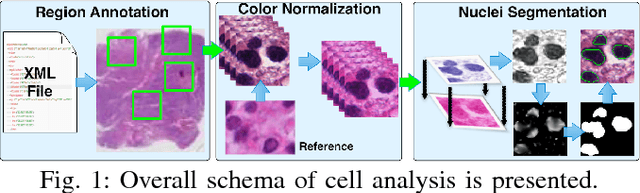 Figure 1 for Analysis of Cellular Feature Differences of Astrocytomas with Distinct Mutational Profiles Using Digitized Histopathology Images