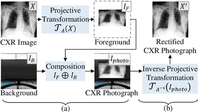 Figure 3 for Projective Transformation Rectification for Camera-captured Chest X-ray Photograph Interpretation with Synthetic Data