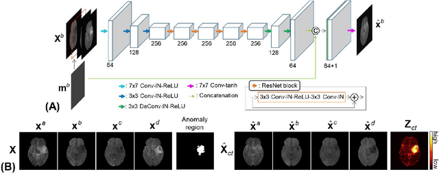 Figure 3 for Unsupervised Anomaly Detection in MR Images using Multi-Contrast Information