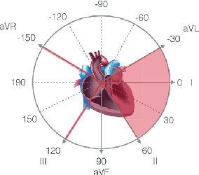 Figure 1 for CLOCS: Contrastive Learning of Cardiac Signals