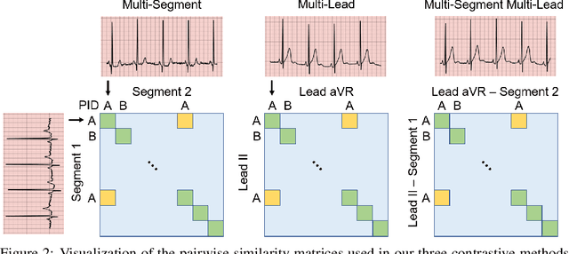 Figure 3 for CLOCS: Contrastive Learning of Cardiac Signals