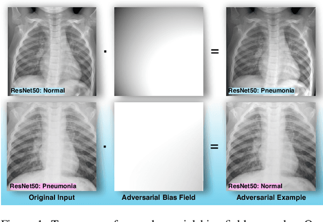 Figure 1 for Bias Field Poses a Threat to DNN-based X-Ray Recognition