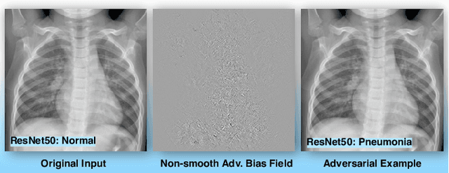 Figure 3 for Bias Field Poses a Threat to DNN-based X-Ray Recognition
