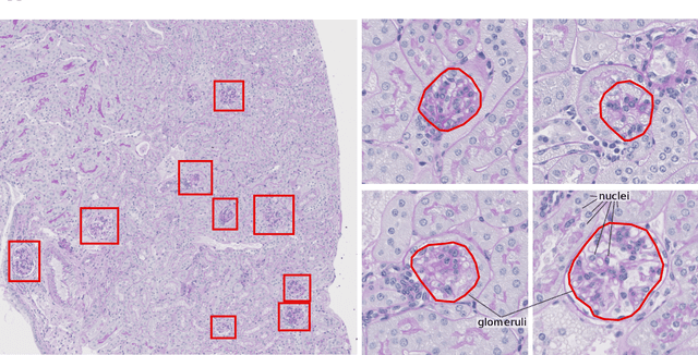 Figure 1 for Unsupervisedly Training GANs for Segmenting Digital Pathology with Automatically Generated Annotations