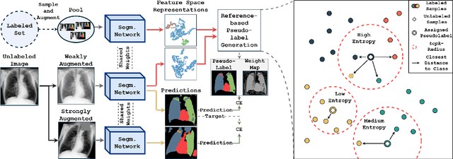 Figure 3 for Reference-guided Pseudo-Label Generation for Medical Semantic Segmentation