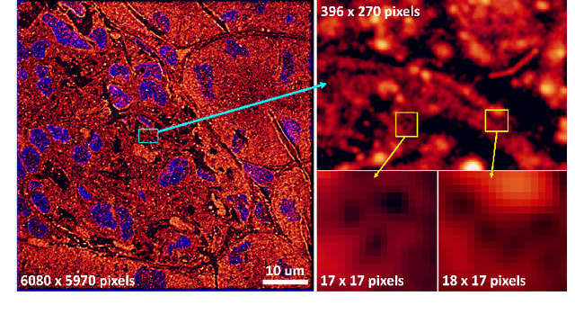 Figure 1 for UltraMNIST Classification: A Benchmark to Train CNNs for Very Large Images