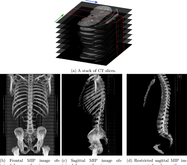 Figure 1 for Fully-automated deep learning slice-based muscle estimation from CT images for sarcopenia assessment