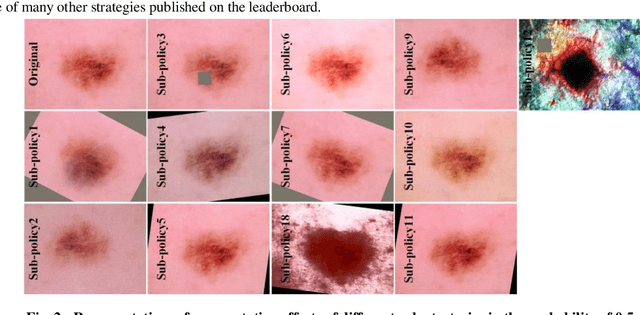 Figure 3 for Low-cost and high-performance data augmentation for deep-learning-based skin lesion classification