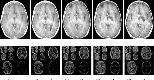 Figure 1 for Compressed sensing for longitudinal MRI: An adaptive-weighted approach